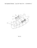 SPINAL ALIGNMENT CORRECTION SYSTEM AND METHODS OF USE diagram and image