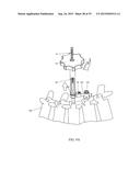 SPINAL ALIGNMENT CORRECTION SYSTEM AND METHODS OF USE diagram and image