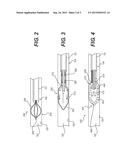 DEVICES FOR REDUCING LUNG VOLUME AND RELATED METHODS OF USE diagram and image