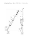 VACUUM COAGULATION PROBES diagram and image