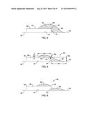 NERVE ABLATION DEVICES AND RELATED METHODS OF USE AND MANUFACTURE diagram and image