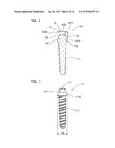 IMPLANT OVERDENTURE SYSTEM AND IMPLANT diagram and image