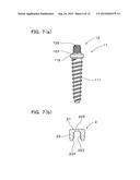 IMPLANT OVERDENTURE SYSTEM AND IMPLANT diagram and image