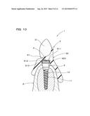 IMPLANT OVERDENTURE SYSTEM AND IMPLANT diagram and image