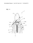 IMPLANT OVERDENTURE SYSTEM AND IMPLANT diagram and image