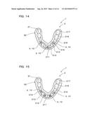 IMPLANT OVERDENTURE SYSTEM AND IMPLANT diagram and image