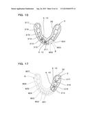 IMPLANT OVERDENTURE SYSTEM AND IMPLANT diagram and image