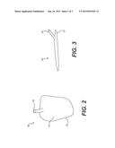 DEVICES FOR SIZING A CAVITY TO FIT AN ORGAN AND RELATED METHODS OF USE diagram and image