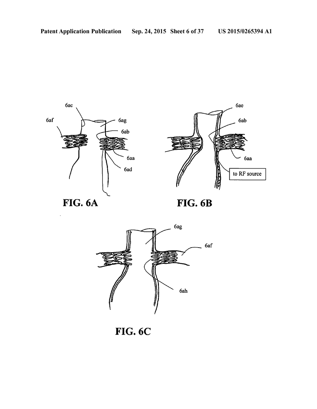 DEVICES AND METHODS FOR TREATMENT OF ABDOMINAL AORTIC ANEURYSMS - diagram, schematic, and image 07