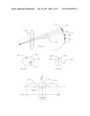 DUAL-OPTIC INTRAOCULAR LENS THAT IMPROVES OVERALL VISION WHERE THERE IS A     LOCAL LOSS OF RETINAL FUNCTION diagram and image