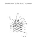 HEARTVALVE IMPLANT diagram and image