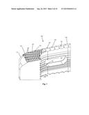 Intervertebral Implant diagram and image