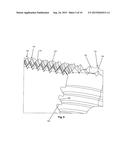 Intervertebral Implant diagram and image