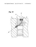 ORTHOPEDIC IMPLANTS WITH FLEXIBLE SCREWS diagram and image