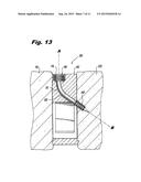 ORTHOPEDIC IMPLANTS WITH FLEXIBLE SCREWS diagram and image