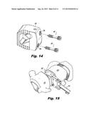 ORTHOPEDIC IMPLANTS WITH FLEXIBLE SCREWS diagram and image