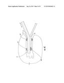 FLUID FLOWING DEVICE AND METHOD FOR TISSUE DIAGNOSIS OR THERAPY diagram and image