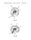 ALPHA ADRENERIC RECEPTOR AGONISTS FOR TREATMENT OF DEGENERATIVE DISC     DISEASE diagram and image