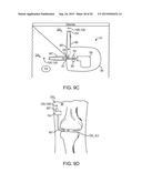 SOLID DRUG DELIVERY APPARATUS, FORMULATIONS AND METHODS OF USE diagram and image