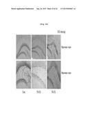 Composition Comprising Centipede Grass Extracts or Fractions Thereof as     Active Ingredients diagram and image