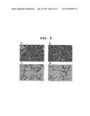 THERAPEUTIC AGENT FOR CANCER diagram and image