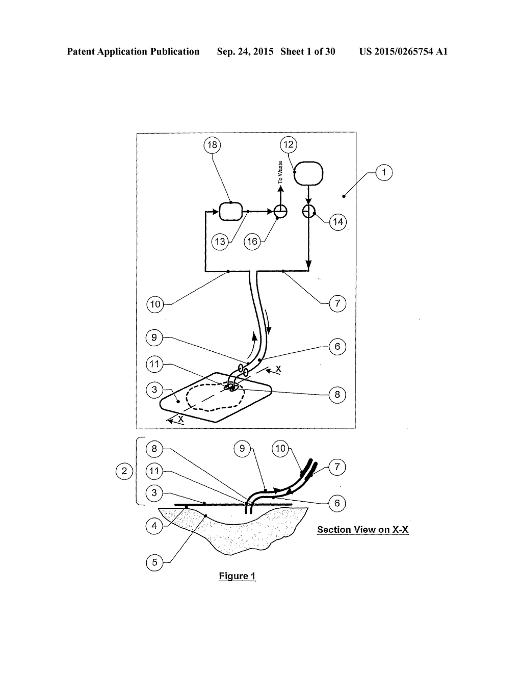 DRESSING AND APPARATUS FOR CLEANSING THE WOUNDS - diagram, schematic, and image 02