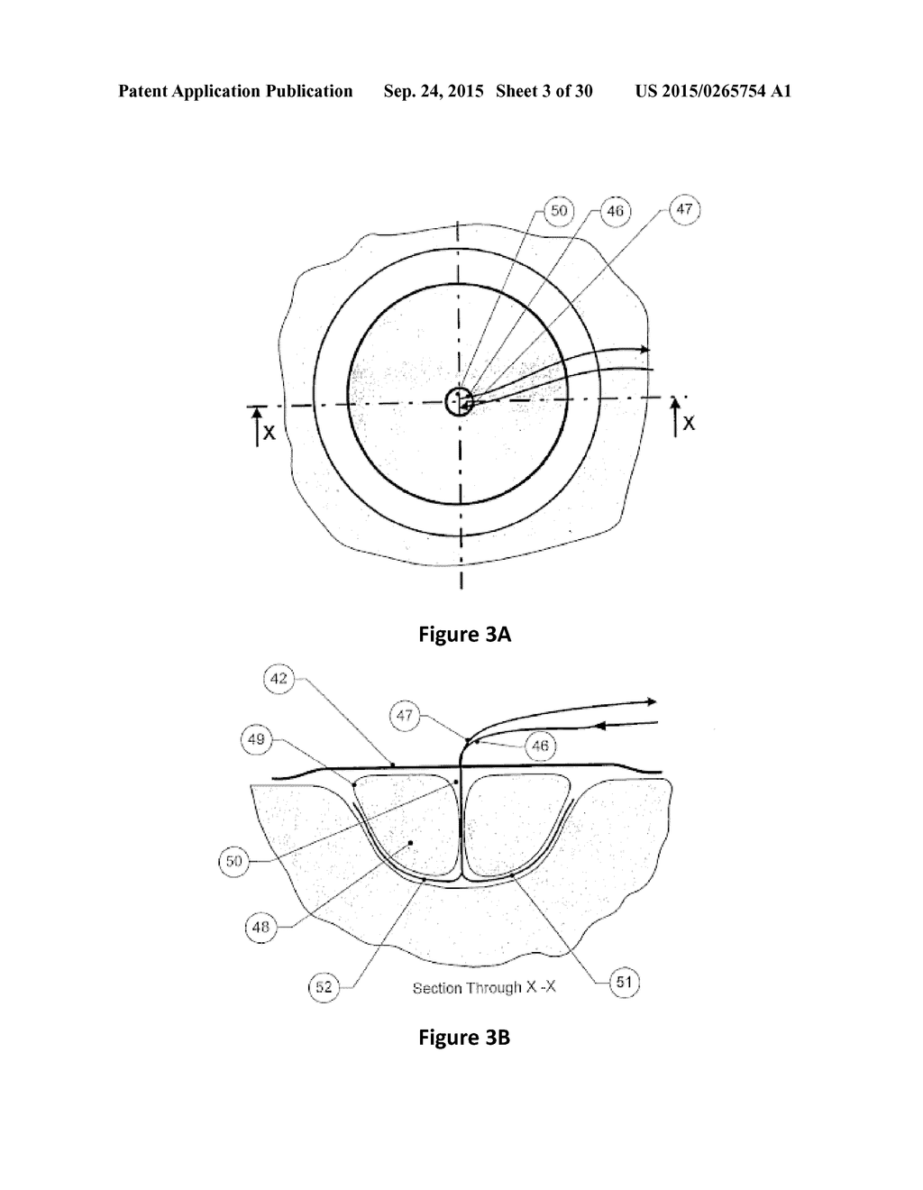 DRESSING AND APPARATUS FOR CLEANSING THE WOUNDS - diagram, schematic, and image 04