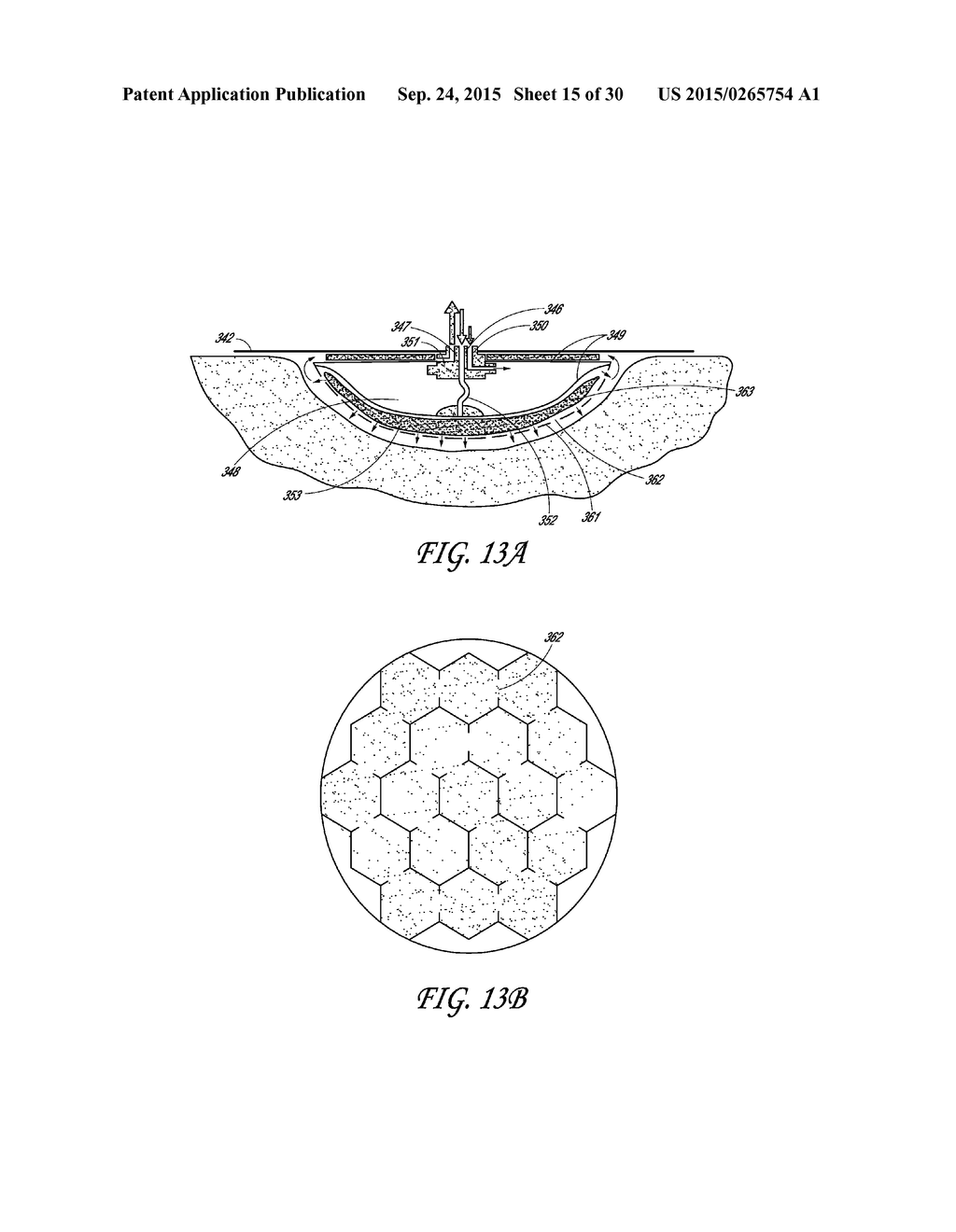 DRESSING AND APPARATUS FOR CLEANSING THE WOUNDS - diagram, schematic, and image 16