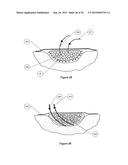 DRESSING AND APPARATUS FOR CLEANSING THE WOUNDS diagram and image