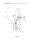 APPARATUS AND METHOD FOR IMPROVED ASSISTED VENTILATION diagram and image