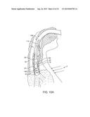 APPARATUS AND METHOD FOR IMPROVED ASSISTED VENTILATION diagram and image