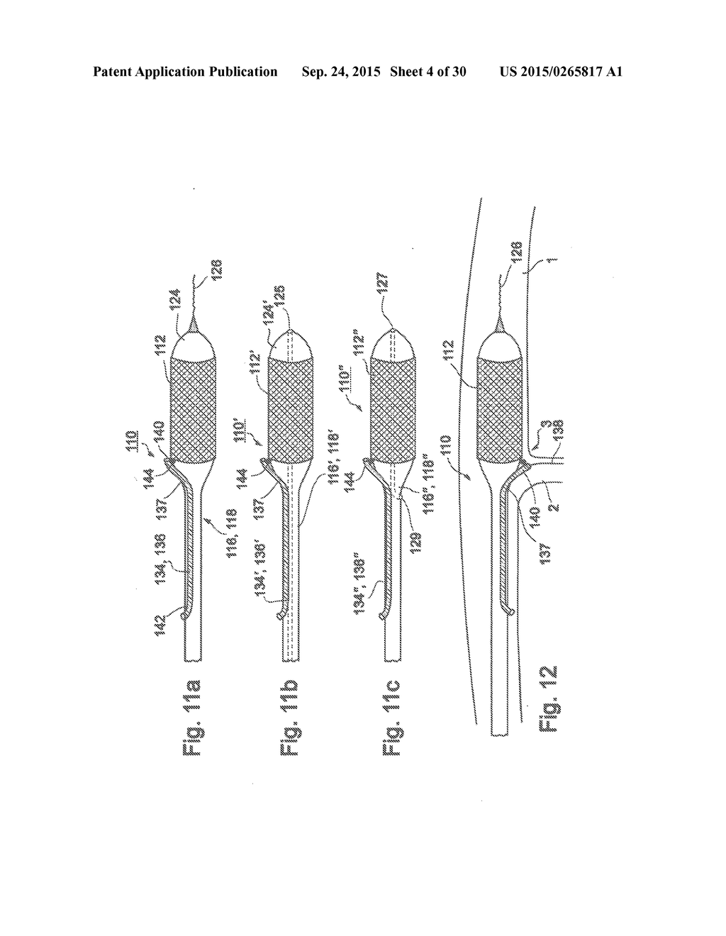 Positioning Device For Ostial Lesions - diagram, schematic, and image 05