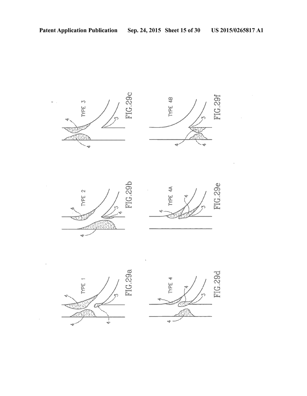 Positioning Device For Ostial Lesions - diagram, schematic, and image 16