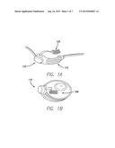 Electrode Arrays and Their Lead for Use in Biomedical Implants diagram and image