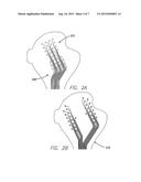 Electrode Arrays and Their Lead for Use in Biomedical Implants diagram and image