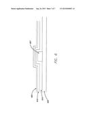 Electrode Arrays and Their Lead for Use in Biomedical Implants diagram and image