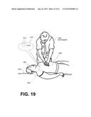 WEARABLE CARDIAC DEFIBRILLATOR SYSTEM EMITTING CPR PROMPTS diagram and image