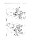 HEADREST DUMP ASSEMBLY WITH BOTH CABLE AND PUSH BUTTON ACTUATION diagram and image