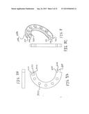 BENDING STRAIN RELIEF ASSEMBLY FOR MARINE CABLES INCORPORATING AT LEAST     ONE ELONGATED STIFFNESS MEMBER diagram and image