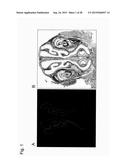 VACCINE FOR TREATMENT OF TAUTOPATHY diagram and image