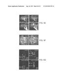 METHODS AND COMPOSITIONS FOR MODULATING ANGIOGENESIS diagram and image