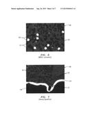 METHOD AND APPARATUS FOR AUTOMATED PLATELET IDENTIFICATION WITHIN A WHOLE     BLOOD SAMPLE FROM MICROSCOPY IMAGES diagram and image