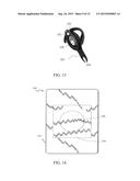 PATIENT MONITORING APPLIANCE diagram and image