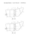 SINGLE FIBER FORCE-SENSING OF BOTH AXIAL AND BENDING CATHETER TIP FORCES diagram and image