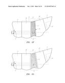 SINGLE FIBER FORCE-SENSING OF BOTH AXIAL AND BENDING CATHETER TIP FORCES diagram and image