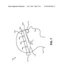 SYSTEMS AND METHODS FOR PORTABLE NEUROFEEDBACK diagram and image