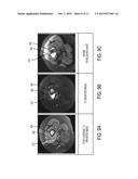 ESTIMATION OF INCOHERENT MOTION PARAMETERS FROM DIFFUSION-WEIGHTED MRI     DATA diagram and image