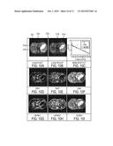 ESTIMATION OF INCOHERENT MOTION PARAMETERS FROM DIFFUSION-WEIGHTED MRI     DATA diagram and image