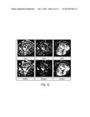 ESTIMATION OF INCOHERENT MOTION PARAMETERS FROM DIFFUSION-WEIGHTED MRI     DATA diagram and image