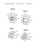 APICAL PUNCTURE ACCESS AND CLOSURE SYSTEM diagram and image